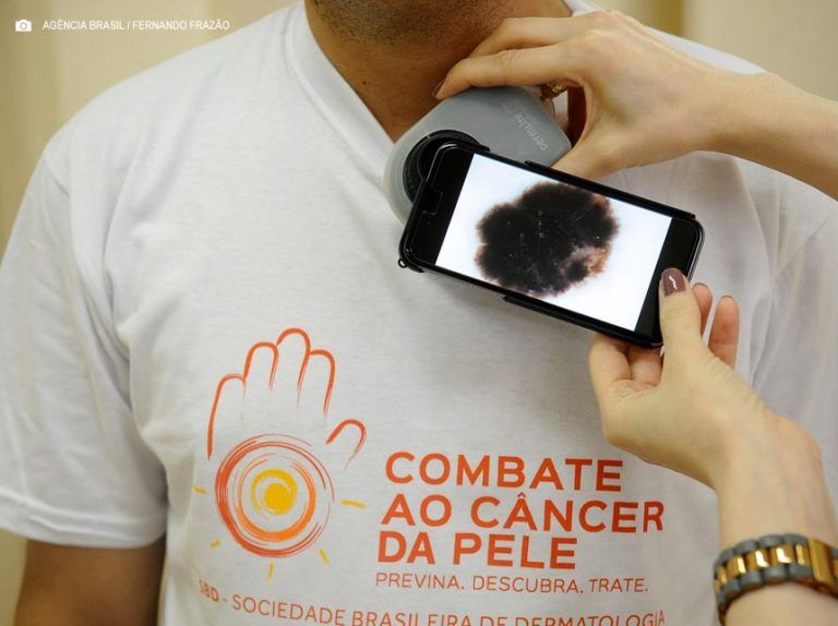 Mutirão atende população no dia de combate ao câncer de pele